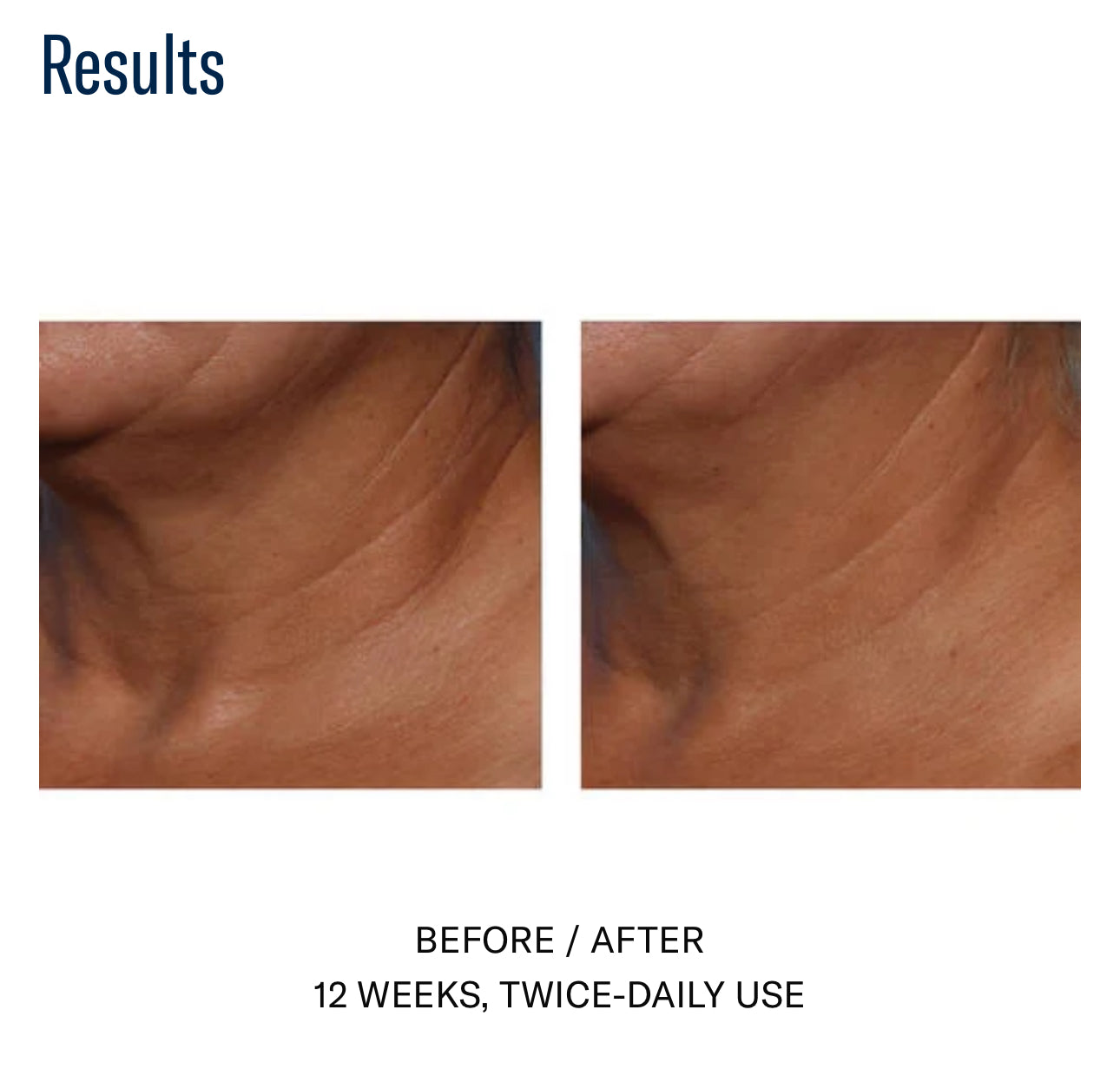 Techno Neck Perfecting Cream