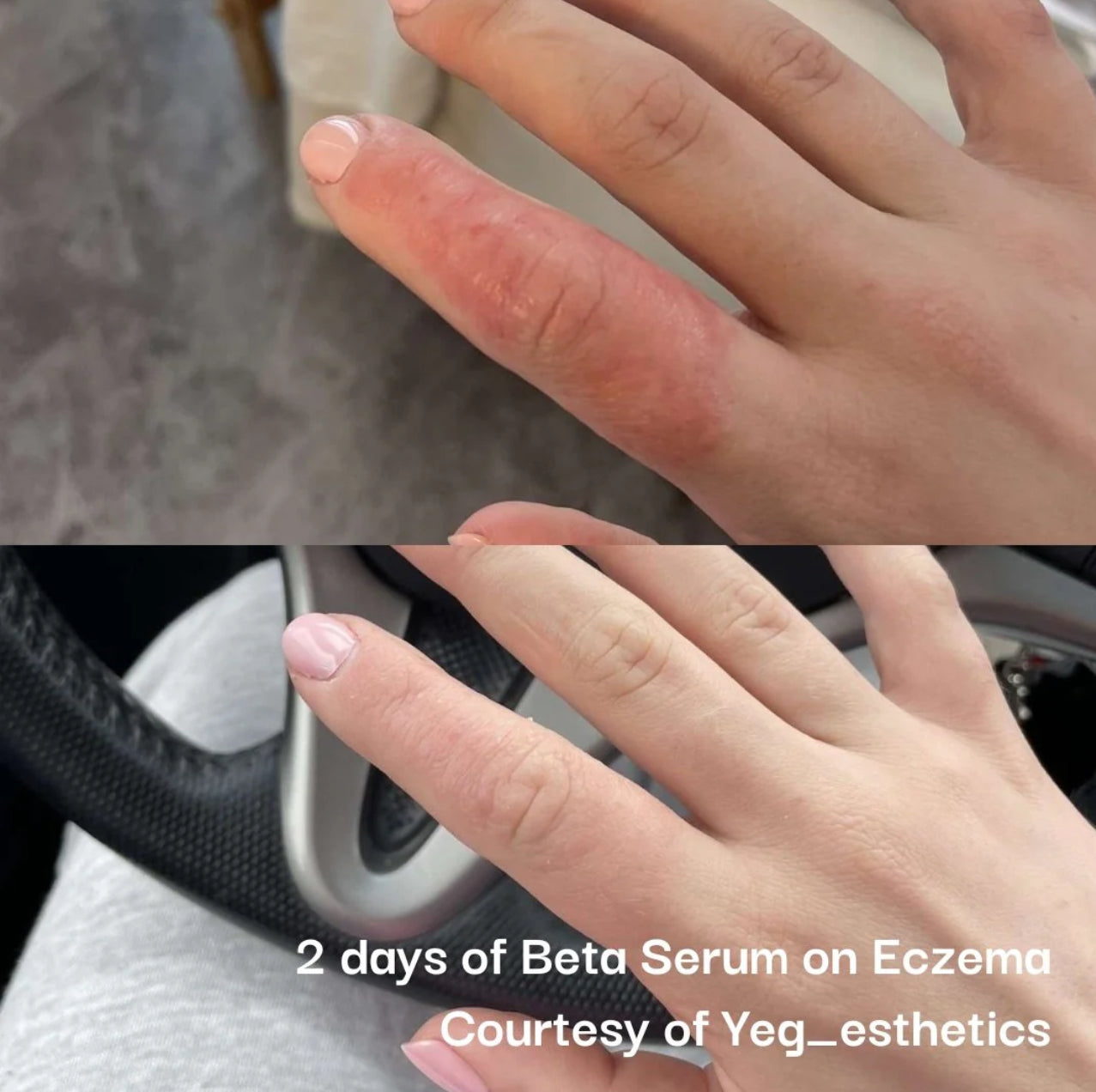 Beta-Glucan Serum