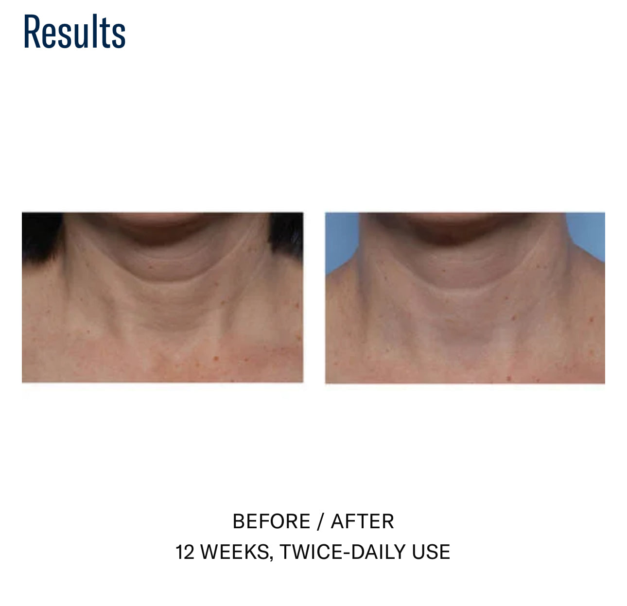 Techno Neck Perfecting Cream