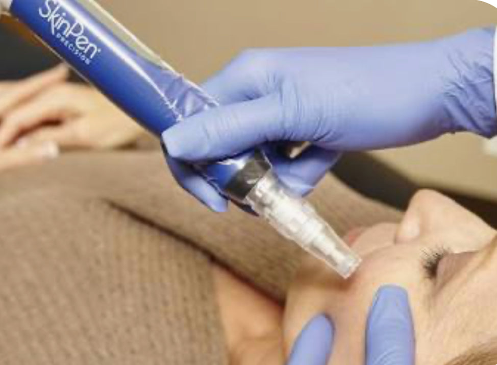 SkinPen Microneedling Package