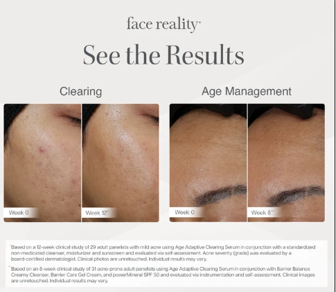 Age Adaptive Clearing Serum