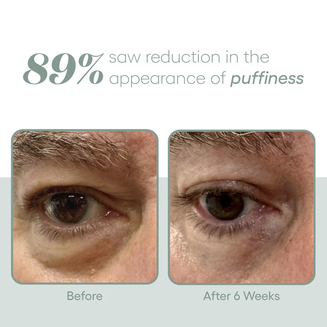 (plated)™️ EYE Serum