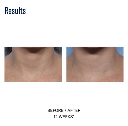Techno Neck Perfecting Cream