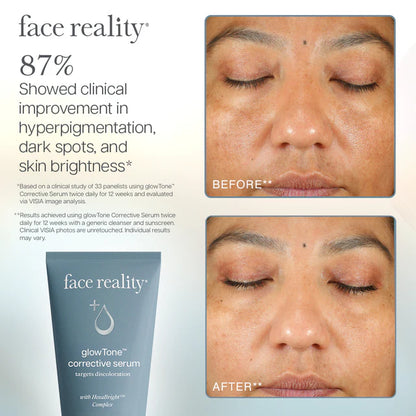 glowTone™ Corrective Serum